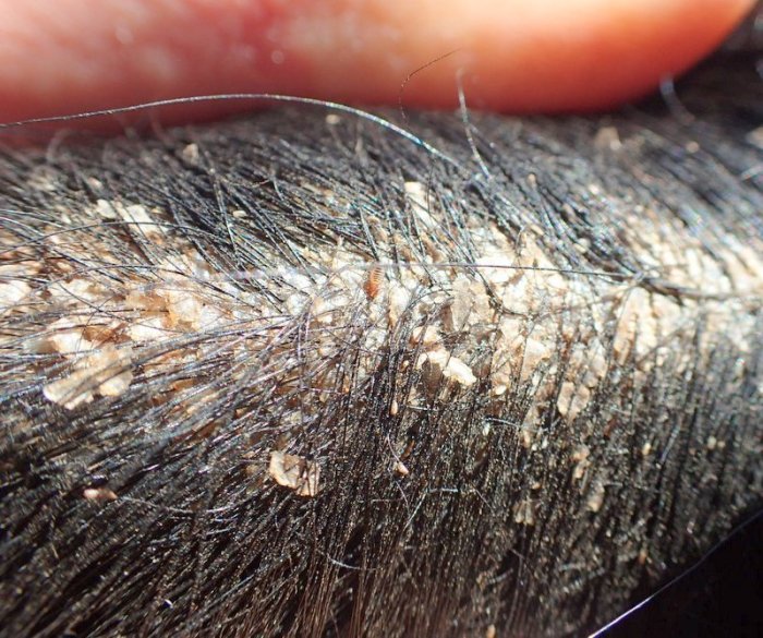 Pictures of lice on cattle